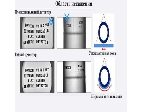 Комплекс цифровой радиографии КАРАТ РТС 1036 с гибким детектором 4
