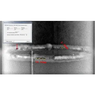 Комплекс цифровой радиографии Экоскан 3030/14