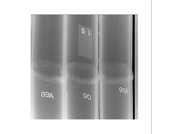 Рентгеновский аппарат МОНОСКАН 3 4