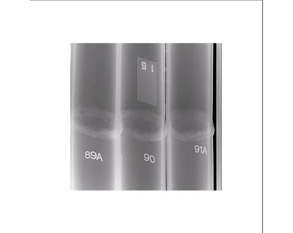 Рентгеновский аппарат МОНОСКАН 1 2