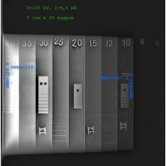 Комплекс цифровой радиографии ЦИФРАКОН 1230