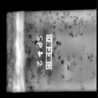 Комплекс цифровой радиографии СКРИНТЕСТ 20M