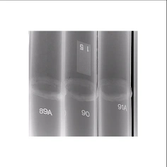 Рентгеновский аппарат МОНОСКАН 1