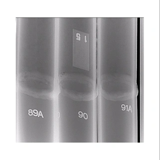 Рентгеновский аппарат МОНОСКАН 3